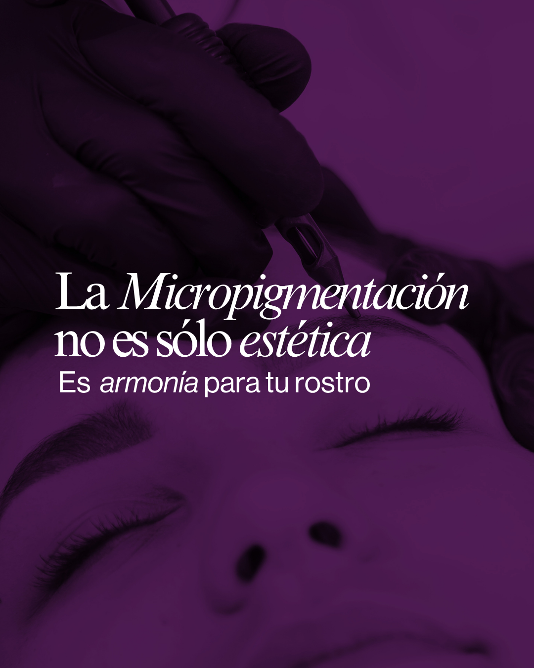 Resultado micropigmentación Centro SEDA 1