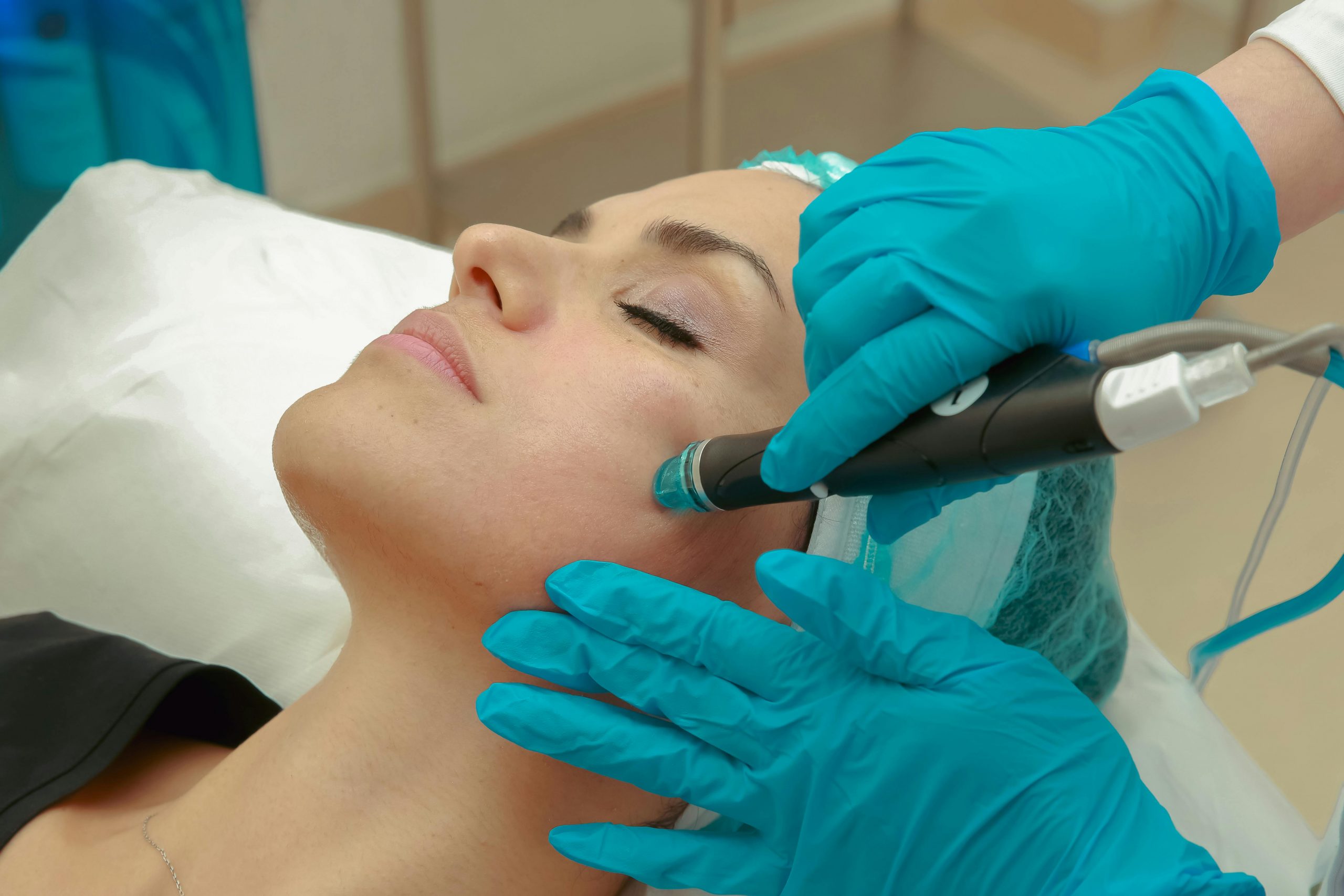 Tratamiento Dermapen en Centro SEDA La Línea